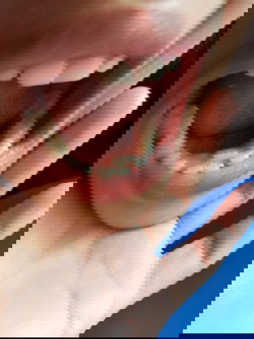 New Tooth of 5years old