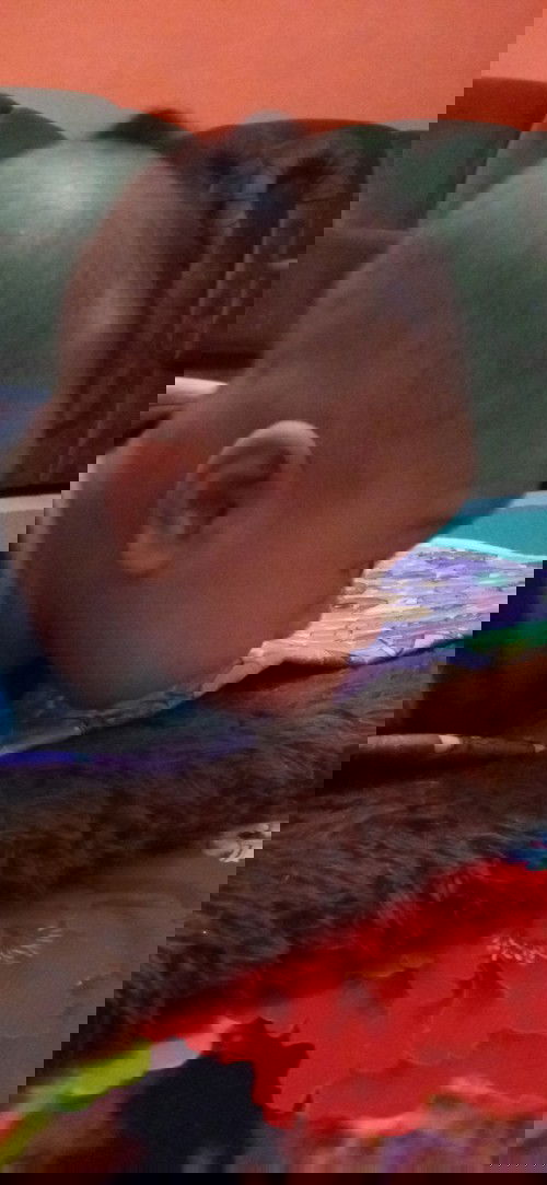 Kulit merah di area pup