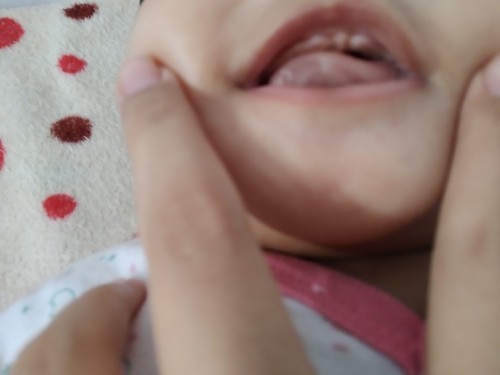 gusi bayi