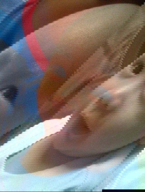 Jahitan pasca melahirkan normal