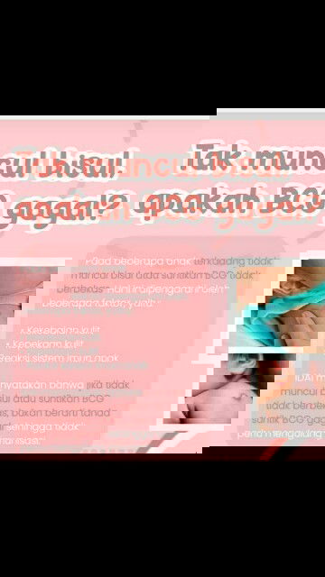 Tak muncul bisul BCG