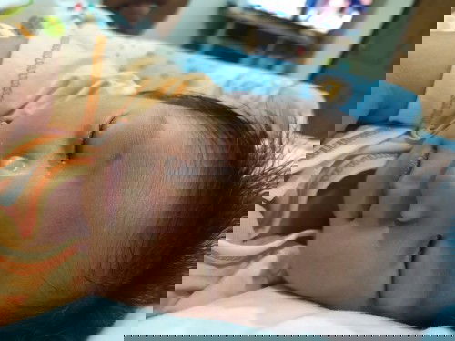 น้องตาแฉะมีขี้ตา