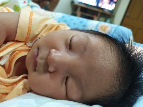 น้องตาแฉะมีขี้ตา