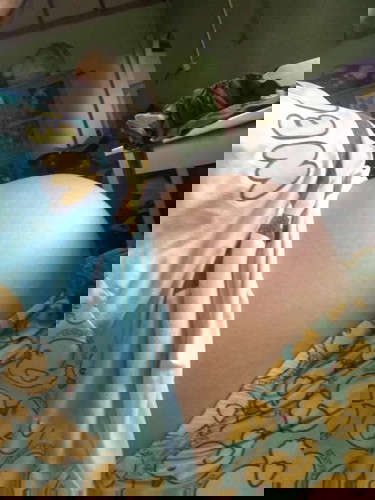 33+5 แล้ว ท้องแข็งบ่อยมากหายใจหอบ