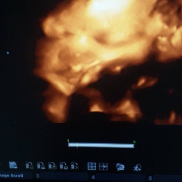 ซาว ตอน33w