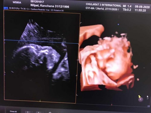 แม่ๆเดือนพย.กี่วีคกันบ้างค่ะ