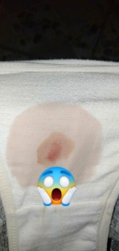 Konting spot @ 39 weeks