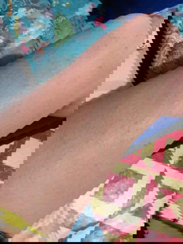 Skin problem
