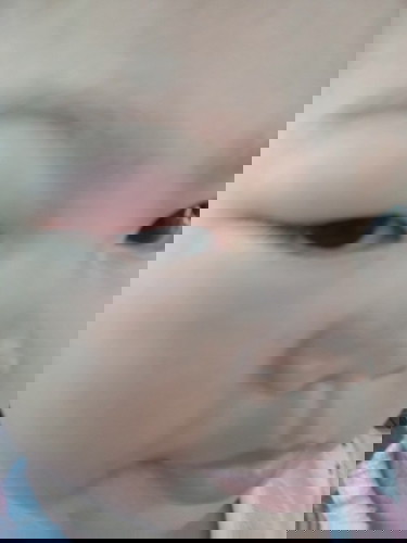 ลูกตาบวมไม่รู้ว่าเหตุ