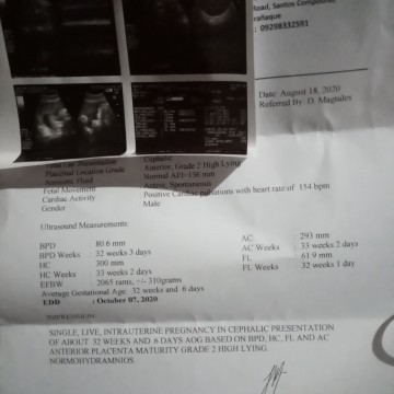 Ultrasound
