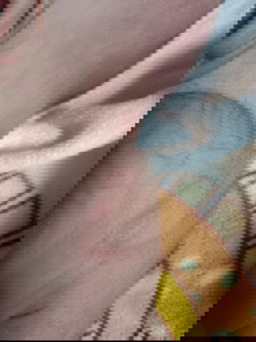 Tanda bulat di bahu kanan bayi