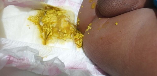 color ng poops ni baby