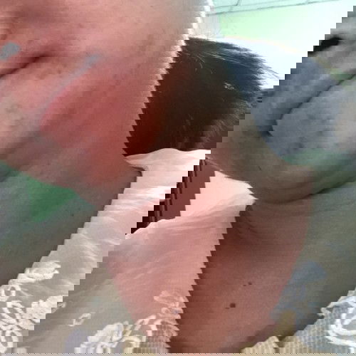 แม่คนไหนโหดแบบนี้บ้างค่ะ ลูกชาย 36week สิว ผิวดำคล้ำจนเปลี่ยนสีจากก่อนท้องเลย แล้วคลอดมาลูกจะหมองคล้ำแบบแม่ไหม