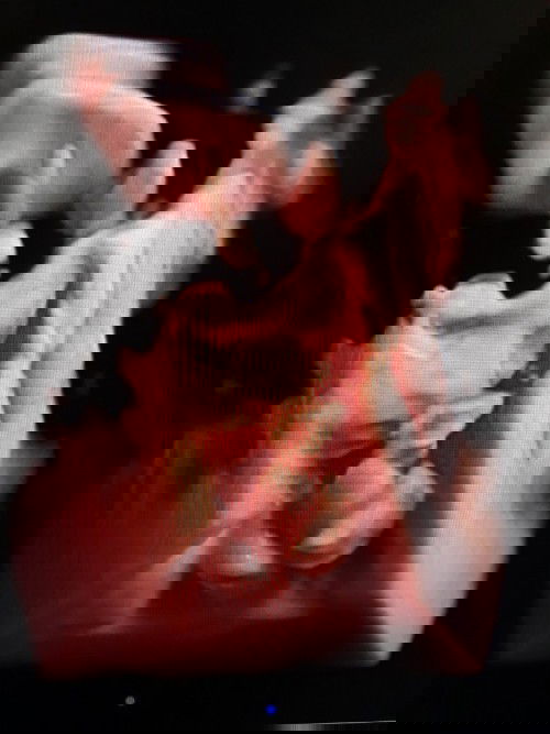 HPL berbeda pdhl BBJ normal