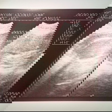 WHAT WILL I DO ? 🥺