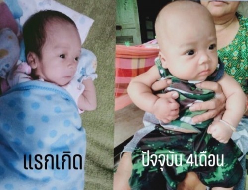 จากเด็กน้อยคลอดก่อนกำหนด 32+4 วิค☺️