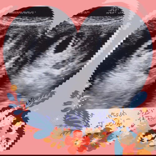 มีความกังวลใจขอคำแนะนำจากแม่ๆด้วยค่ะ