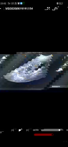 ตั้งครรภ์