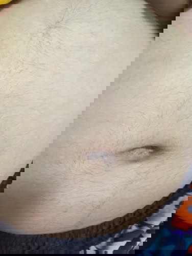 ตั้งครรภ์ 16 w ท้องแรก