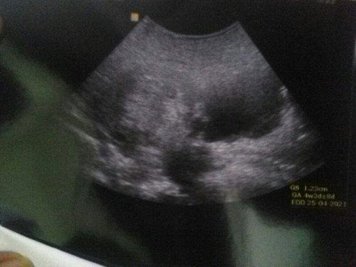 Hasil USG 6week