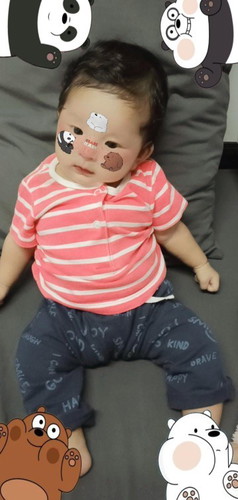 ฉีดวัคซีน 2 เดือน