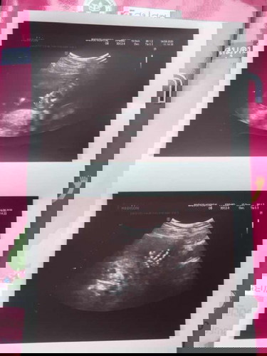 คุนแม่บ้านไหนอยากได้ลูกสาวบ้างแต่ได้ลูกชายแทน