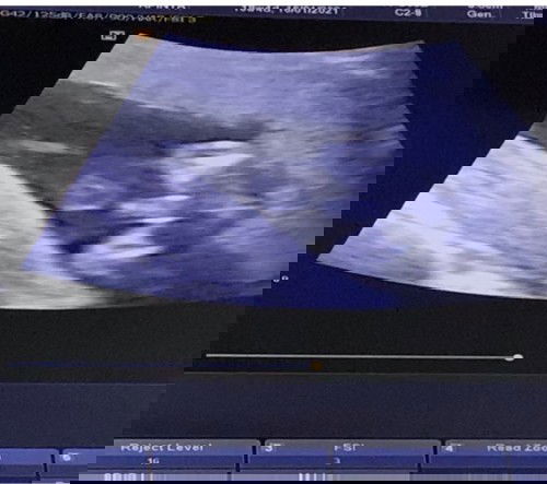 หญิง หรือ ขายค่ะ