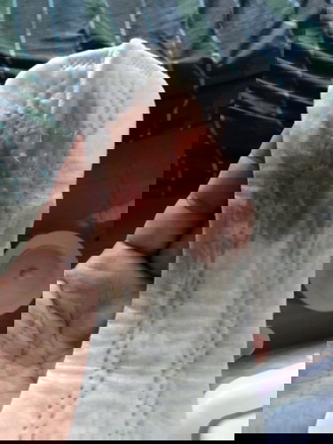 Vaginal discharge