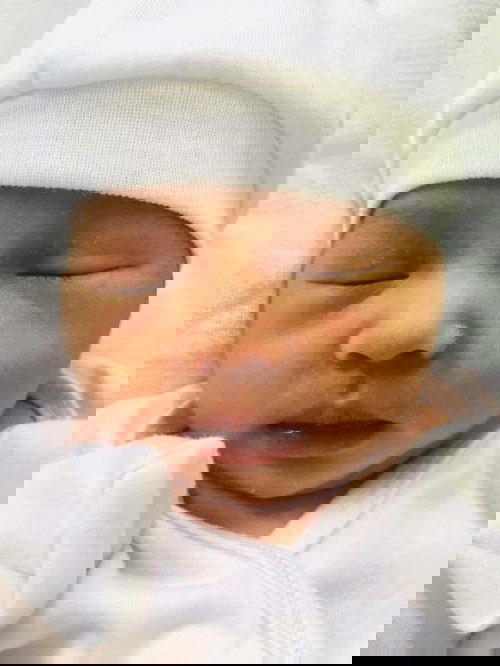 Pantal sa mukha 3 days old palang si baby