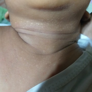 neck