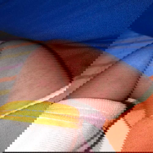 Ruam merah pada bayi