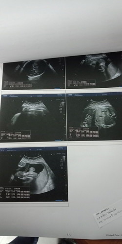 ได้ลูกชายสมใจพ่อแม่