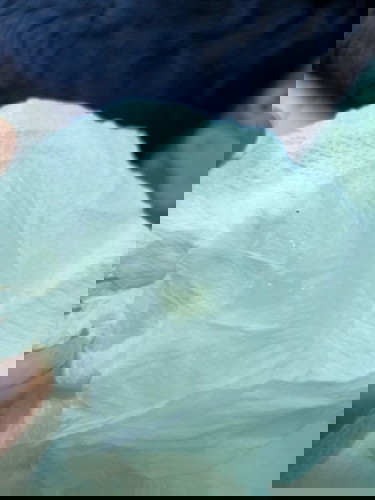 มูกหรือตกขาวคะ