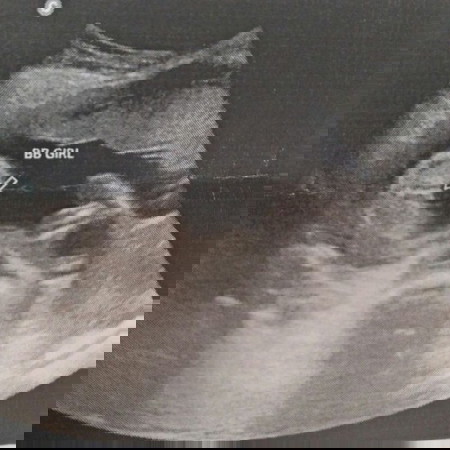 22 Weeks and 4 Days Gender