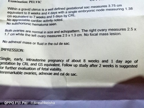 Hopefully may heart beat na c baby