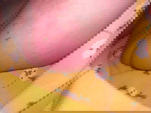 Con ai bị như vậy ko chỉ e cách chữa với có phải bị dị ứng ko