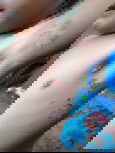 Adakah mom yg anaknya pernah mengalami ini? Awalnya hanya satu sekarang udah banyak seperti ini.