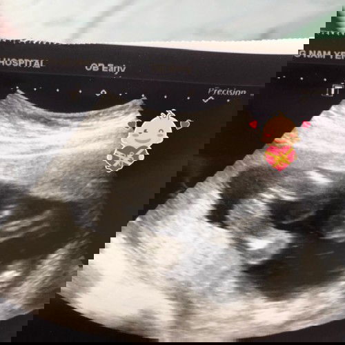 แม่ๆช่วยดูหน่อยค่ะ ลูกชายหรือลูกสาวคะ