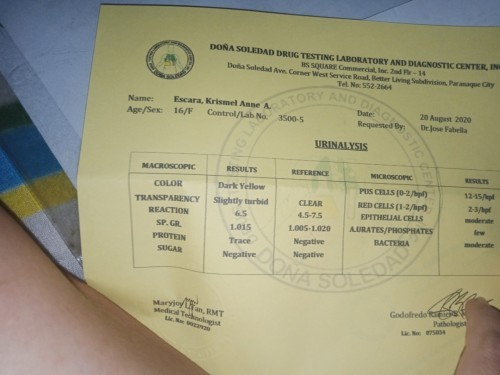 URINALYSIS