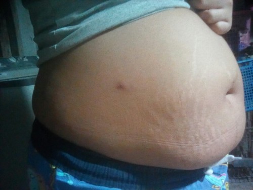 17สัปดาห์4วัน ใหญ่ไปมั้ย ท้อง2จร้