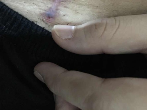 Dapat bang ikabahala?