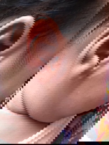 Rashes po bah ito or any infection?