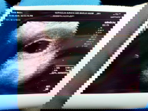 salam. ada siapa2 boleh explain pasal gamba scan ni?