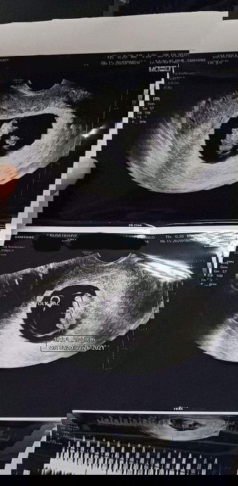 Heartbeat at 9 weeks ♥️