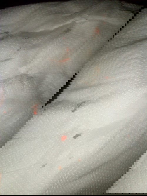 33+1 wค่ะแต่มีเลือดซึม