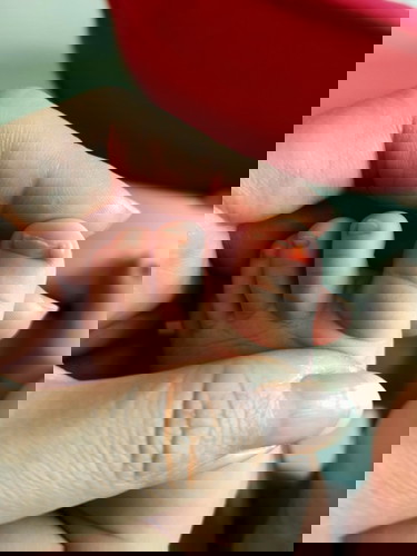 Swollen toe