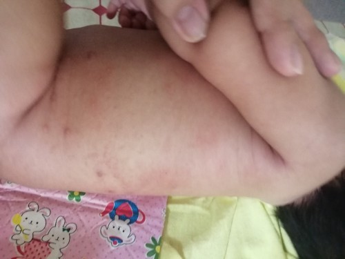 Pantal s tiyan at likod