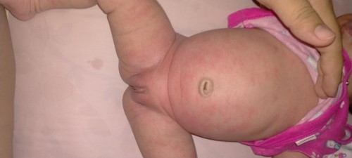 สอบถามแม่ลูกอ่อนหน่อยค่ะ