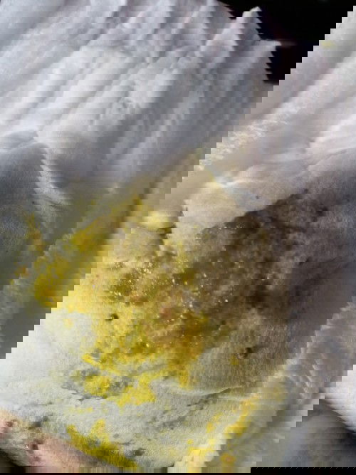 Tiêu hóa trẻ sơ sinh