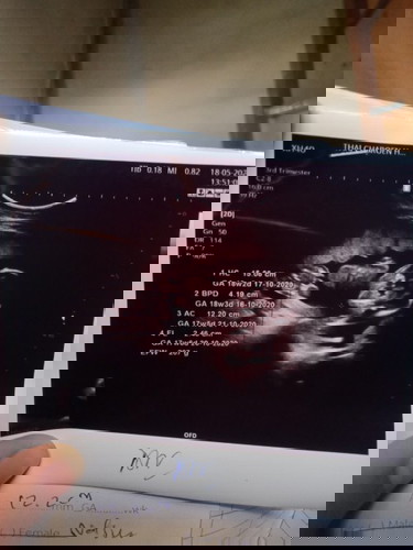 แม่ๆทายเล่นๆนะคะ